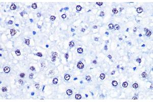 Immunohistochemistry of paraffin-embedded Rat liver using CHD4 Polyclonal Antibody at dilution of 1:100 (40x lens). (CHD4 Antikörper)