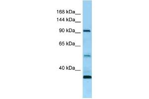 Western Blotting (WB) image for anti-Receptor Tyrosine Kinase-Like Orphan Receptor 1 (ROR1) (N-Term) antibody (ABIN2789669) (ROR1 Antikörper  (N-Term))