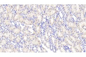 Immunohistochemistry (IHC) image for anti-Angiogenin (ANG) (AA 25-142) antibody (ABIN7430318)