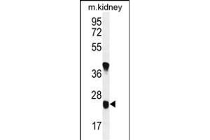 U119B Antibody (C-term) (ABIN654979 and ABIN2844619) western blot analysis in mouse kidney tissue lysates (35 μg/lane). (UNC119B Antikörper  (C-Term))