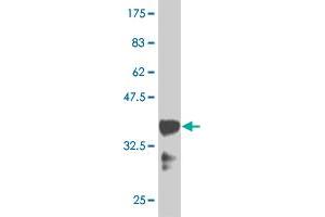 Western Blot detection against Immunogen (36. (HOXB9 Antikörper  (AA 65-163))
