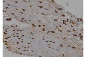 ABIN6276493 at 1/100 staining Human gastric tissue by IHC-P.