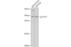 Western blot analysis of extracts of various cell lines using p27 KIP 1 Polyclonal Antibody at dilution of 1:3000. (CDKN1B Antikörper)