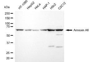 anti-Annexin A6 (ANXA6) antibody
