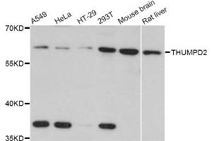 Western blot analysis of extracts of various cell lines, using THUMPD2 Antibody (ABIN4905417) at 1:3000 dilution. (THUMPD2 Antikörper)