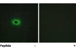 Immunofluorescence analysis of HeLa cells, using SDC4 polyclonal antibody . (SDC4 Antikörper  (Ser179))