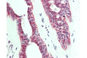 Immunohistochemistry (IHC) image for anti-Protein Tyrosine Phosphatase-Like (Proline Instead of Catalytic Arginine), Member A (PTPLA) (AA 37-66) antibody (ABIN1927972)