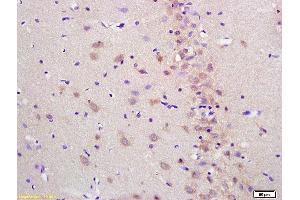 Formalin-fixed and paraffin embedded rat brain labeled with Anti-Cytosine deaminase Polyclonal Antibody, Unconjugated (ABIN682138) at 1:200 followed by conjugation to the secondary antibody and DAB staining (Cytosine Deaminase Antikörper)