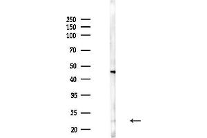 anti-RAB22A, Member RAS Oncogene Family (RAB22A) (C-Term) antibody