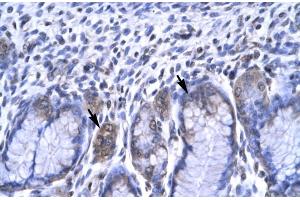 Immunohistochemistry (IHC) image for anti-Recombination Signal Binding Protein For Immunoglobulin kappa J Region (RBPJ) (C-Term) antibody (ABIN2777213)