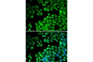 Immunofluorescence analysis of U2OS cells using KMT2E antibody (ABIN5973619). (MLL5/KMT2E Antikörper)