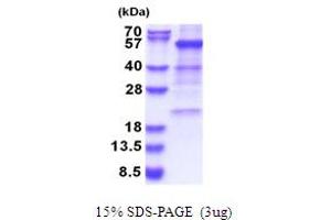 SDS-PAGE (SDS) image for Glutamate Dehydrogenase 1 (GLUD1) (AA 54-558) protein (His tag) (ABIN5853669)