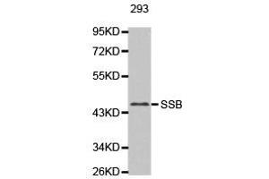 Western Blotting (WB) image for anti-Sjogren Syndrome Antigen B (SSB) antibody (ABIN1874948) (SSB Antikörper)