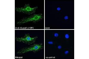 ABIN361185 Immunofluorescence analysis of paraformaldehyde fixed HeLa cells, permeabilized with 0.
