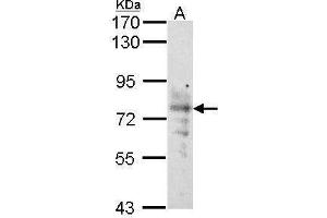 WB Image Sample (30 ug of whole cell lysate) A: Raji 7. (SLC5A1 Antikörper  (Center))