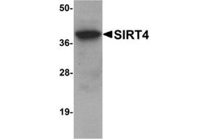 Western blot analysis of SIRT4 in human liver tissue lysate with SIRT4 antibody at 1 μg/ml. (SIRT4 Antikörper  (N-Term))