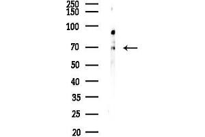 Western blot analysis of lysates from COLO205 cells(UV,30 min treatment), using ZNF496 Antibody at 1/1000 dilution.