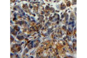 Used in DAB staining on fromalin fixed paraffin-embedded pancreas tissue (PDIA2 Antikörper  (AA 309-525))