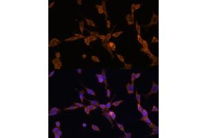 Immunofluorescence analysis of NIH/3T3 cells using UBE2J1 antibody (ABIN7271172) at dilution of 1:100. (UBE2J1 Antikörper  (AA 1-100))