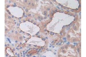 IHC-P analysis of Human Kidney Tissue, with DAB staining. (SLC12A3 Antikörper  (AA 3-146))