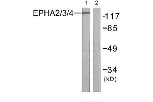 Western Blotting (WB) image for anti-EPH Receptor A2/3/4 (EPHA2/3/4) (Tyr588), (Tyr596) antibody (ABIN1848022) (EPHA2/3/4 Antikörper  (Tyr588, Tyr596))