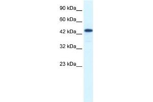 WB Suggested Anti-RCOR3 Antibody Titration:  1. (RCOR3 Antikörper  (N-Term))