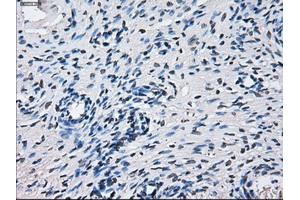 Immunohistochemical staining of paraffin-embedded Ovary tissue using anti-CYP2E1 mouse monoclonal antibody.