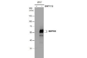WB Image BMPR1B antibody detects BMPR1B protein by western blot analysis. (BMPR1B Antikörper)