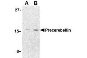 Image no. 1 for anti-Cerebellin 1 Precursor (CBLN1) (C-Term) antibody (ABIN200081) (CBLN1 Antikörper  (C-Term))