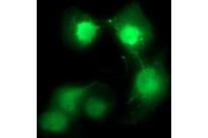 Image no. 2 for anti-Cell Division Cycle 123 Homolog (CDC123) antibody (ABIN1497388) (CDC123 Antikörper)
