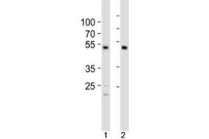 Western blot analysis of lysate from 1) HCT116 cell line and 2) human heart tissue using SOX7 antibody at 1:1000. (SOX7 Antikörper  (C-Term))