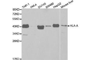 Western blot analysis of extracts of various cell lines, using HLA-A antibody. (HLA-A Antikörper  (AA 35-285))