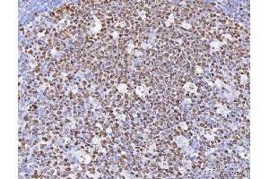 IHC analysis of MCM6 using anti-MCM6 antibody (ABIN7600035). (MCM6 Antikörper  (AA 14-821))