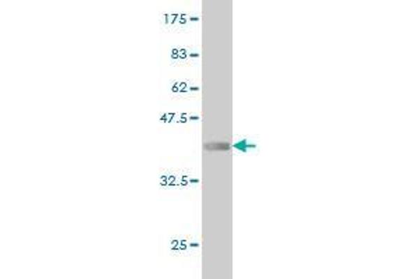 Zinc Finger Protein 650 (ZNF650) (AA 1-110) Antikörper