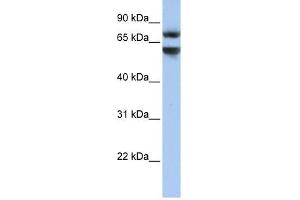 Junctophilin 3 antibody used at 1 ug/ml to detect target protein.