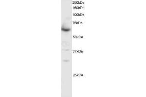 Image no. 1 for anti-SMAD Family Member 4 (SMAD4) (C-Term) antibody (ABIN374104) (SMAD4 Antikörper  (C-Term))