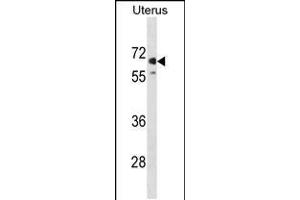Western blot analysis in human Uterus tissue lysates (35ug/lane). (MMEL1 Antikörper  (N-Term))