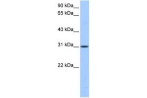 Western Blotting (WB) image for anti-HUS1 Checkpoint Homolog B (HUS1B) antibody (ABIN2463539) (HUS1B Antikörper)