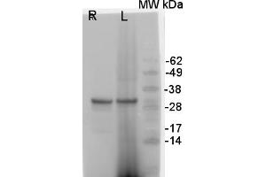 Image no. 1 for anti-ATPase, H+ Transporting, Lysosomal 38kDa, V0 Subunit D2 (ATP6V0D2) (Isoform 1) antibody (ABIN361273) (ATP6V0D2 Antikörper  (Isoform 1))