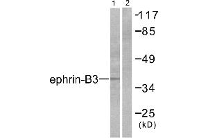 Western blot analysis of extracts from SKOV3 cells, using Ephrin-B3 antibody (#C0182). (Ephrin B3 Antikörper)