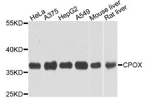 Western blot analysis of extracts of various cell lines, using CPOX antibody. (CPOX Antikörper)