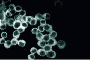 Immunofluorescence (IF) image for anti-Guanine Nucleotide Binding Protein (G Protein), Q Polypeptide (GNAQ) (AA 22-31) antibody (ABIN968914)