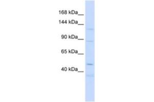 Western Blotting (WB) image for anti-Sterol Regulatory Element Binding Transcription Factor 2 (SREBF2) antibody (ABIN2463718) (SREBF2 Antikörper)