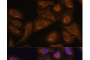 Immunofluorescence analysis of U-2 OS cells using STAR Polyclonal Antibody at dilution of 1:100 (40x lens). (STAR Antikörper)