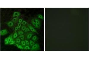 Immunofluorescence analysis of A549 cells, using CSRL1 Antibody. (VN2R1P Antikörper  (AA 400-449))
