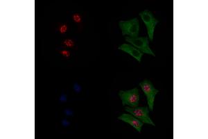 ABIN6256292 and ABIN6267069 staining HepG2 cells(30 min of 4uM Forskolin treatment) by IF/ICC.