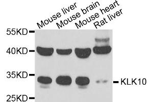 Western blot analysis of extracts of various cell lines, using KLK10 antibody. (Kallikrein 10 Antikörper)