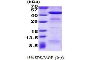 Acetyl-CoA Acyltransferase 2 (ACAA2) (AA 17-397) protein (His tag)