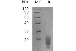 Western Blotting (WB) image for T Cell Immunoreceptor with Ig and ITIM Domains (TIGIT) protein (His tag) (ABIN7320699)