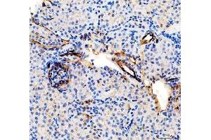 IHC analysis of CD31/Pecam1 using anti-CD31/Pecam1 antibody (ABIN7601662). (CD31 Antikörper  (AA 41-258))